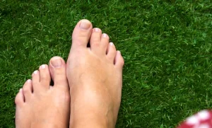 Spiritual Meaning of Webbed Toes